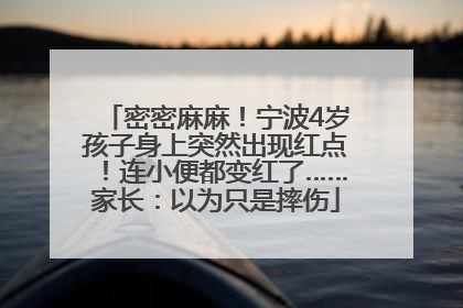 密密麻麻！宁波4岁孩子身上突然出现红点！连小便都变红了……家长：以为只是摔伤