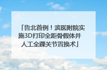 鲁北首例！滨医附院实施3D打印全距骨假体并人工全踝关节置换术